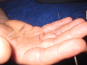 Hand-Akupunktur Gabriele Wieland